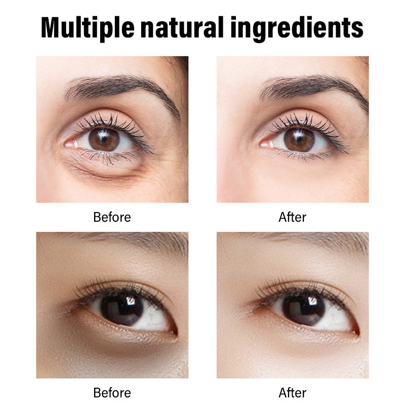 Bright Eyes Ahead: Retinol Cream for Dark Circles